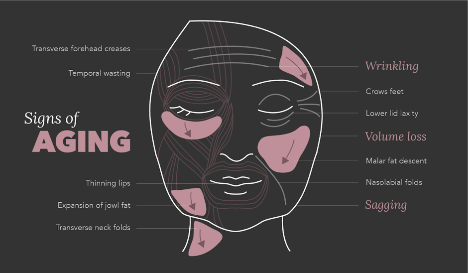 Understanding Wrinkles And Fine Lines 